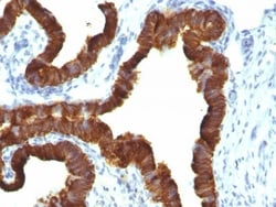 Cytokeratin 7 Antibody (KRT7/1198), Novus Biologicals 0.2mg; Unlabeled:Antibodies,