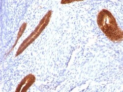 Cytokeratin 7 Antibody (KRT7/760), Novus Biologicals 0.2mg; Unlabeled:Antibodies,