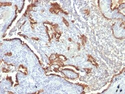 Cytokeratin 7 Antibody (KRT7/760 + OV-TL12/30), Novus Biologicals 0.2mg;