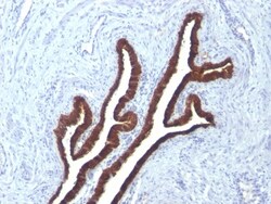 Cytokeratin 7 Antibody (KRT7/760 + KRT7/903), Novus Biologicals 0.2mg;