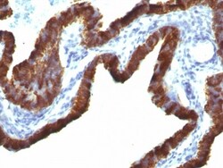 Cytokeratin 7 Antibody (KRT7/760 + OV-TL12/30), Novus Biologicals 0.2mg;