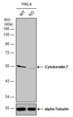 Cytokeratin 7 Antibody, Novus Biologicals 0.1mg; Unlabeled:Anticuerpos
