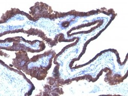 Cytokeratin 8/18 Antibody (C-43 + DC10), Novus Biologicals 0.2mg; Unlabeled:Antibodies,