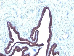 Cytokeratin 8/18 Antibody (KRT8/803 + KRT18/835), Novus Biologicals 0.2mg;