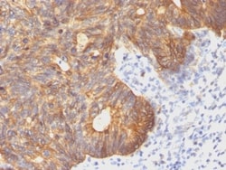 Cytokeratin 8 Antibody (C-43), Novus Biologicals 0.2mg; Unlabeled:Antibodies,