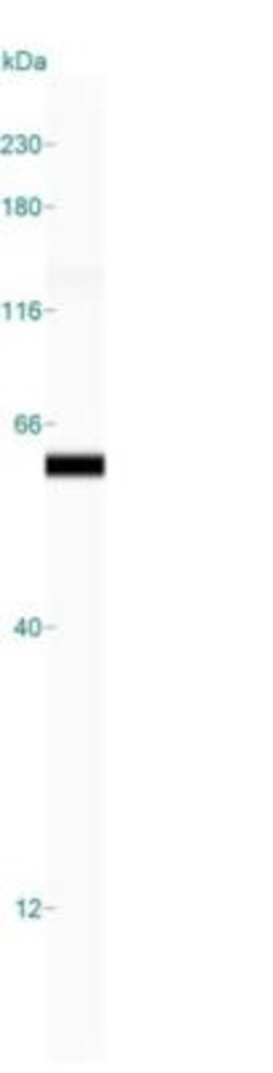 Mouse anti-Cytokeratin 8, Clone: KRT8/899, Novus Biologicals 0.2mg; Unlabeled:Antibodies,