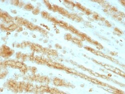 Cytokeratin, pan Antibody (KRTL/1077 + KRTH/1076), Novus Biologicals 0.2mg;