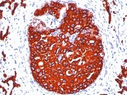 Cytokeratin, pan Antibody (KRTL/1077 + KRTH/1076), Novus Biologicals 0.2mg;