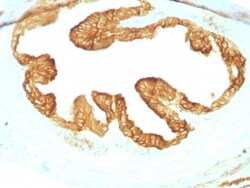 Cytokeratin, pan Antibody (KRTL/1077 + KRTH/1076), Novus Biologicals 0.2mg;