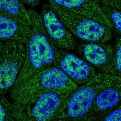 Cytosol Nonspecific Dipeptidase (CNDP2)/CPGL Antibody, Novus Biologicals:Antibodies:Primary