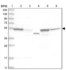 Cytosol Nonspecific Dipeptidase (CNDP2)/CPGL Antibody, Novus Biologicals