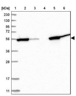 Cytosol Nonspecific Dipeptidase (CNDP2)/CPGL Antibody, Novus Biologicals:Antibodies:Primary