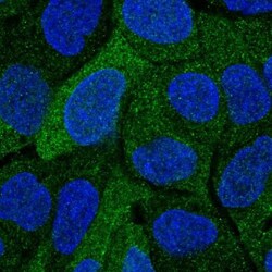Cytosolic Sulfotransferase 2A1/SULT2A1 Antibody, Novus Biologicals:Antibodies:Primary