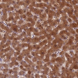 Cytosolic Sulfotransferase 2A1/SULT2A1 Antibody, Novus Biologicals:Antibodies:Primary