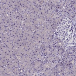 Cytosolic Sulfotransferase 2A1/SULT2A1 Antibody, Novus Biologicals:Antibodies:Primary