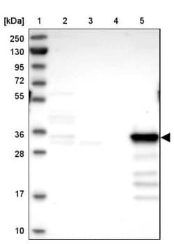 Cytosolic Sulfotransferase 2A1/SULT2A1 Antibody, Novus Biologicals:Antibodies:Primary