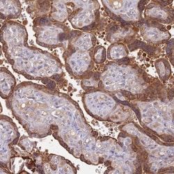 Cytosolic Sulfotransferase 2B1/SULT2B1 Antibody, Novus Biologicals 0.1mL;