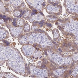 Cytosolic Sulfotransferase 2B1/SULT2B1 Antibody, Novus Biologicals:Antibodies:Primary