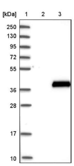 Cytosolic Sulfotransferase 4A1/SULT4A1 Antibody, Novus Biologicals 0.1mL;