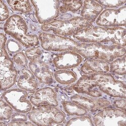 DAAM2 Antibody, Novus Biologicals 25 &mu;L; Unlabeled:Antibodies, Polyclonal