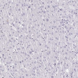 DAB1 Antibody, Novus Biologicals 25 &mu;L, Unlabeled:Antibodies, Polyclonal