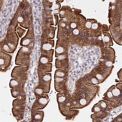 DAB1 Antibody, Novus Biologicals 25 &mu;L, Unlabeled:Antibodies, Polyclonal