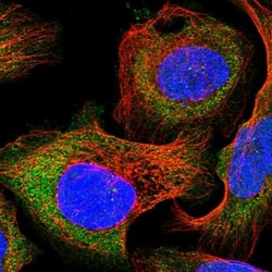 DAK Antibody, Novus Biologicals:Antibodies:Primary Antibodies
