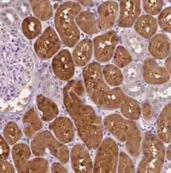 DAK Antibody, Novus Biologicals:Antibodies:Primary Antibodies