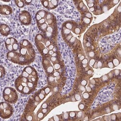 DAK Antibody, Novus Biologicals:Antibodies:Primary Antibodies