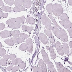 DAK Antibody, Novus Biologicals:Antibodies:Primary Antibodies