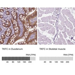 DAK Antibody, Novus Biologicals:Antibodies:Primary Antibodies