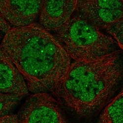 DALRD3 Antibody, Novus Biologicals:Antibodies:Primary Antibodies