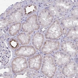 DAOA Antibody, Novus Biologicals 25 &mu;L, Unlabeled:Antibodies, Polyclonal
