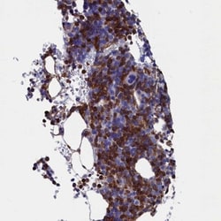 DAP12 Antibody, Novus Biologicals 25 &mu;L; Unlabeled:Antibodies, Polyclonal
