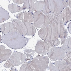 DAP12 Antibody, Novus Biologicals 25 &mu;L; Unlabeled:Antibodies, Polyclonal