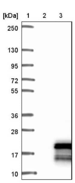 DAP12 Antibody, Novus Biologicals 25 &mu;L; Unlabeled:Antibodies, Polyclonal