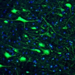 DARPP-32 Antibody, Novus Biologicals 0.1mL; Unlabeled:Antibodies, Polyclonal
