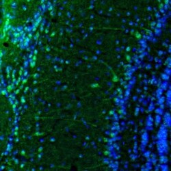 DARPP-32 Antibody, Novus Biologicals 0.1mL; Unlabeled:Antibodies, Polyclonal