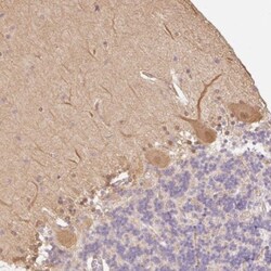 DARPP-32 Antibody, Novus Biologicals 0.1mL; Unlabeled:Antibodies, Polyclonal