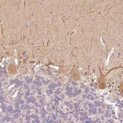 DARPP-32 Antibody, Novus Biologicals 0.1mL; Unlabeled:Antibodies, Polyclonal