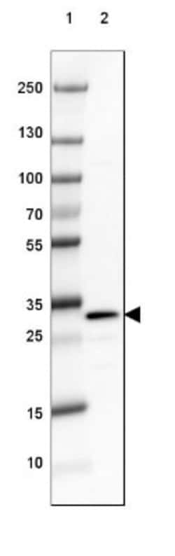 DARPP-32 Antibody, Novus Biologicals 0.1mL; Unlabeled:Antibodies, Polyclonal