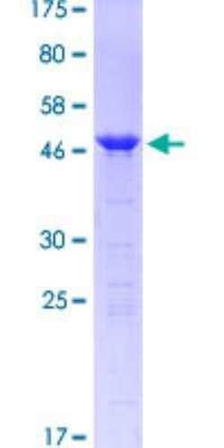 Novus Biologicals Recombinant Human DARPP-32 GST (N-Term) Protein 25 &mu;g | Buy Online | Novus Biologicals&trade; | Fisher Scientific