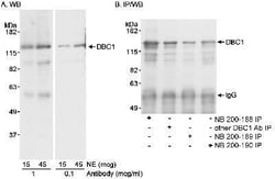 DBC1/p30 Antibody, Novus Biologicals 0.1mL; Unlabeled:Antibodies, Polyclonal