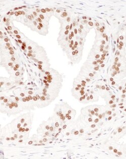 DBC1/p30 Antibody, Novus Biologicals 0.1mg; Unlabeled:Antibodies, Polyclonal