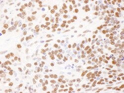 DBC1/p30 Antibody, Novus Biologicals 0.1mg; Unlabeled:Antibodies, Polyclonal