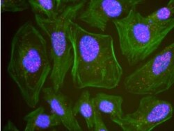 DBC1/p30 Antibody, Novus Biologicals 0.1mg; Unlabeled:Antibodies, Polyclonal