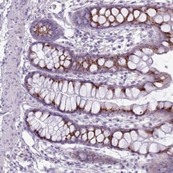 DBF4B Antibody, Novus Biologicals:Antibodies:Primary Antibodies