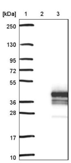 DBNDD2 Antibody, Novus Biologicals 25 &mu;L | Buy Online | Novus Biologicals | Fisher Scientific