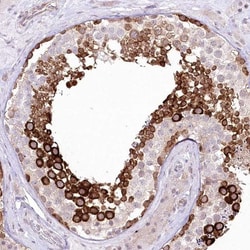 DBPA Antibody, Novus Biologicals:Antibodies:Primary Antibodies