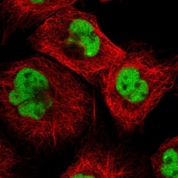 DBR1 Antibody, Novus Biologicals 0.1mL; Unlabeled:Antibodies, Polyclonal